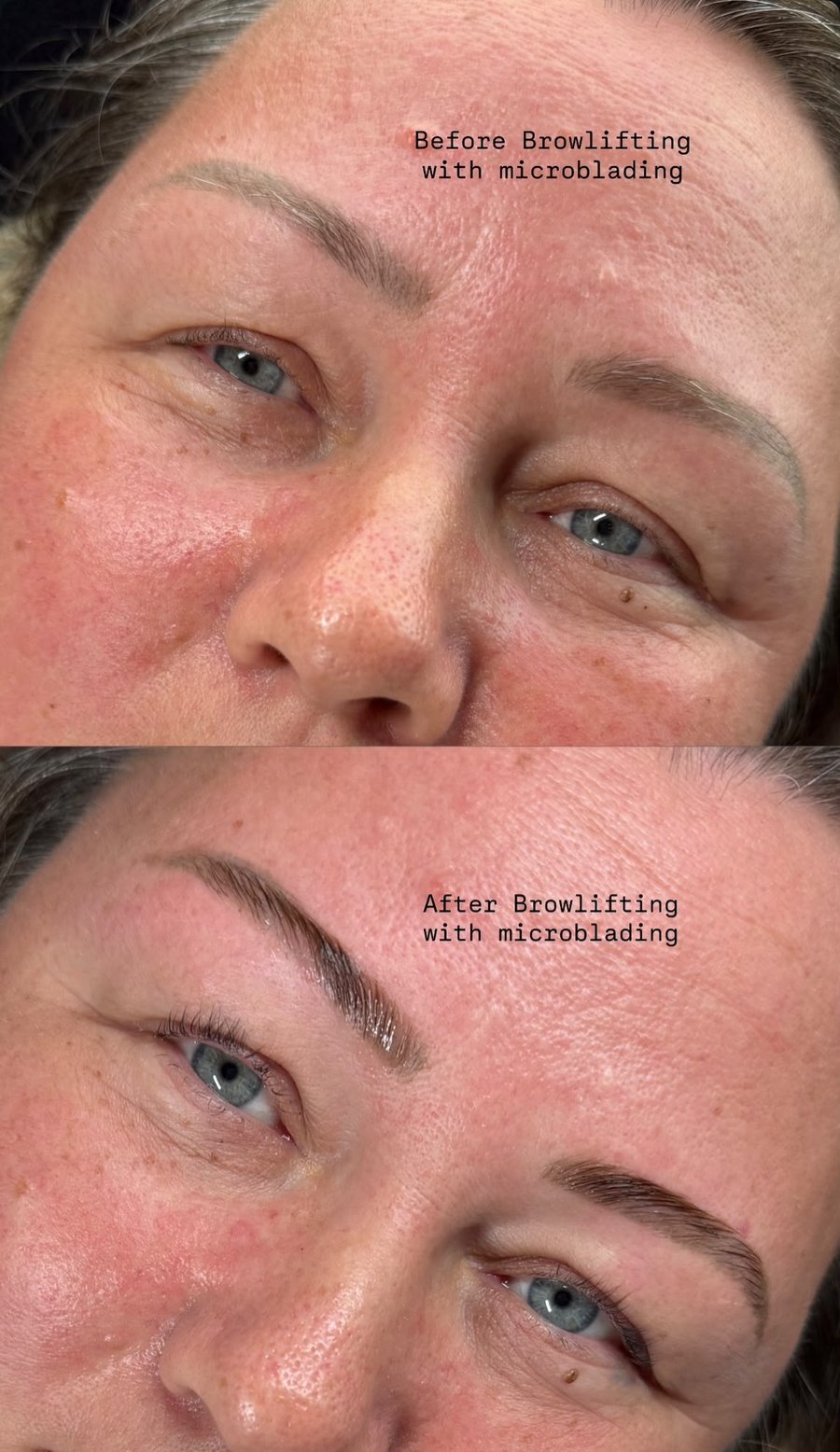 Vorher-Nachher Browlifting mit Microblading