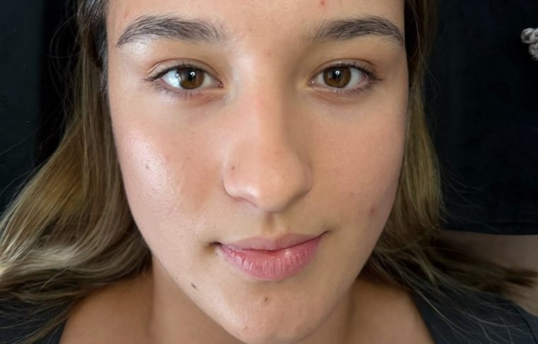 Vorher Lashlifting
